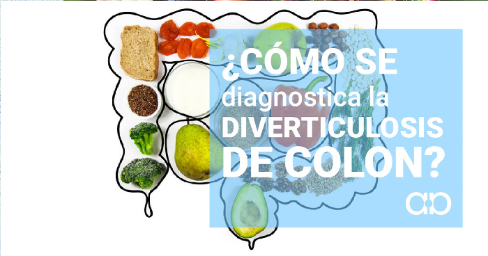 diverticulosis de colon alberdi aparato digestivo