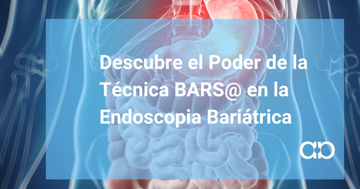 BLOG QUE HACER SI DESPUES DE UNA RREDUCCION DE ESTOMAGO HAS VUELTO A GANAR PESO METODO ROSE2