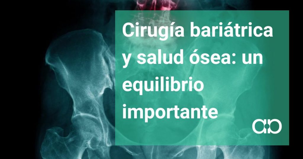 CIRUGIA BARIATRICA Y SALUD OSEA