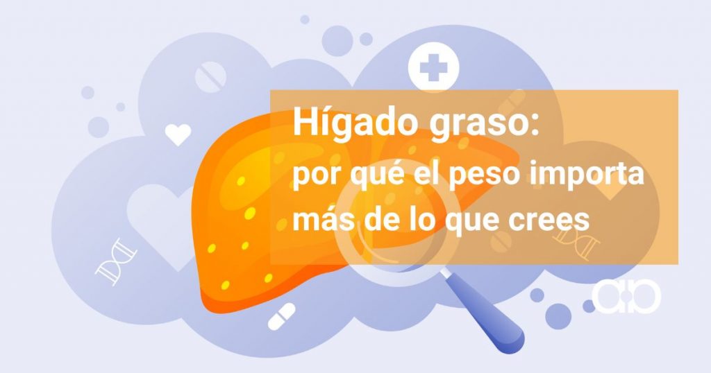 hígado gras y sobre peso