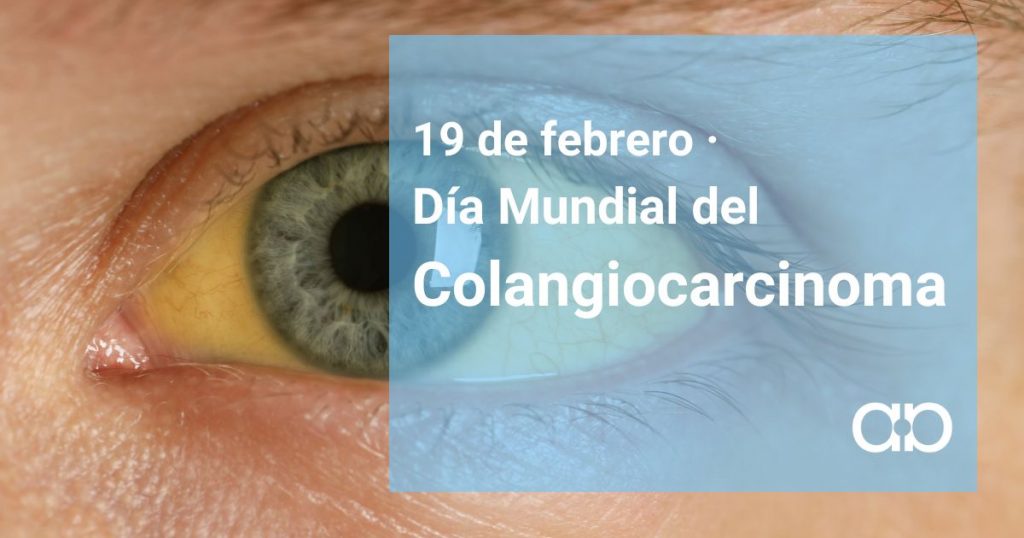 colangiocarcinoma