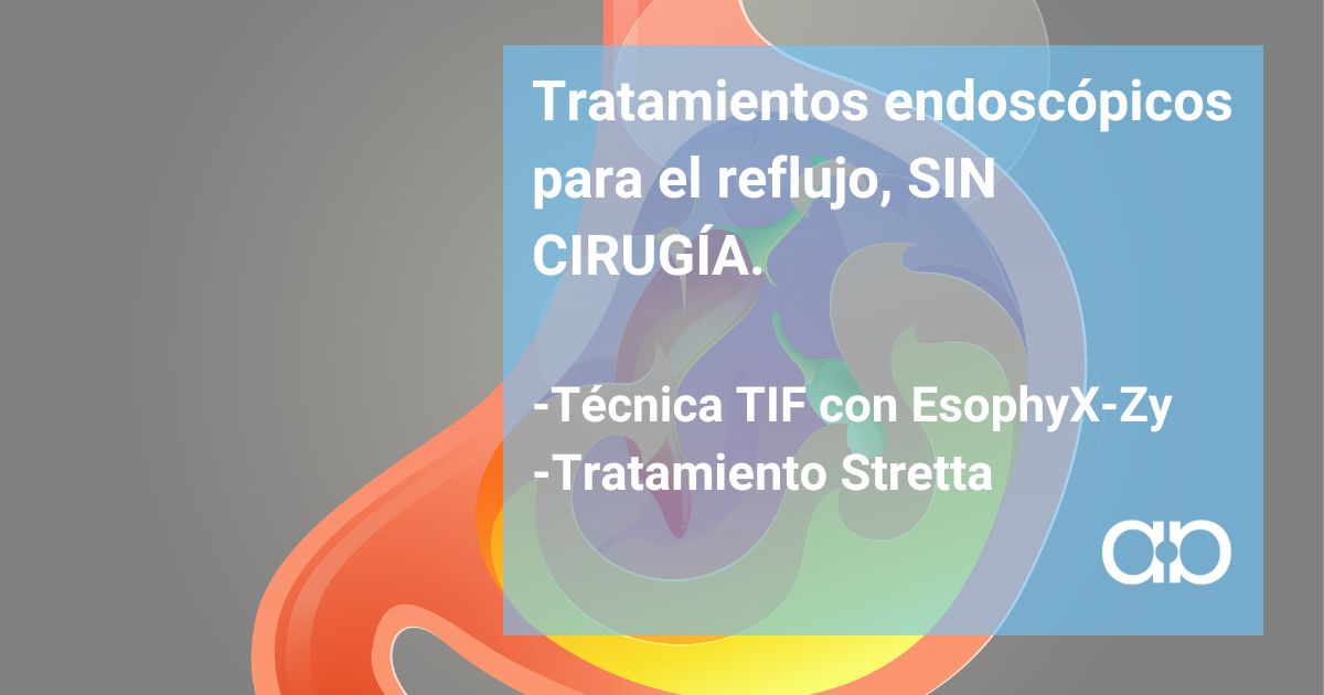 TRATAMIENTO PARA ERL REFLUJO SIN CIRUGIA TIF Y STRETTA