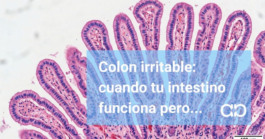 Colon irritable