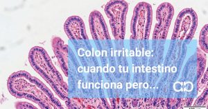 Colon irritable