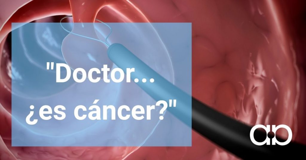 ¿Puede un pólipo convertirse en cáncer? Todo lo que debes saber después de una colonoscopia